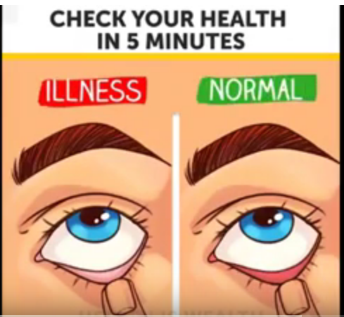 Check Your Health in 5 Minutes